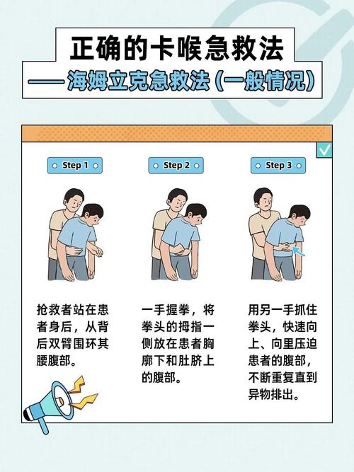 急救常识(工作人员应学会并熟悉哪些急救常识)